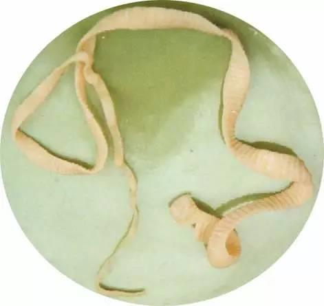 最恐怖的15大人类杀手：第一竟然是蚊子