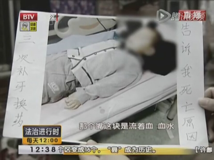 四岁男童补牙离奇猝死 最后时刻大喊放开我