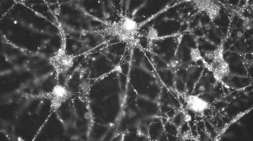 清除突触的基因同精神分裂症存在关联