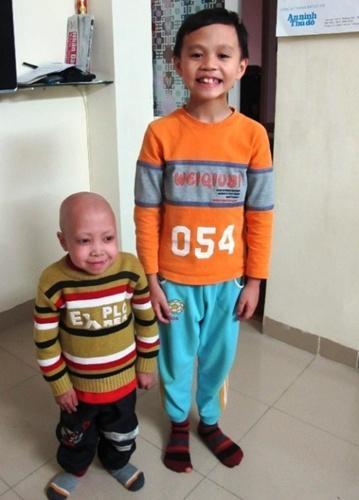 少年患病似吸血鬼 盘点全球匪夷所思怪病(组图)