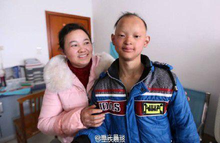 少年患病似吸血鬼(胆小勿进) 扒全球怪病：少女一笑就瘫(图)
