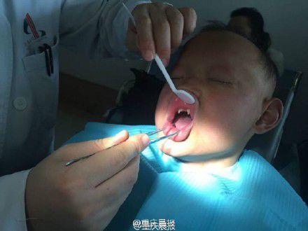 少年患病似吸血鬼(胆小勿进) 扒全球怪病：少女一笑就瘫(图)