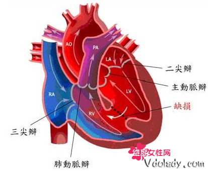 男童患罕见先心病心脏动脉长反 不动手术随时有生命危险