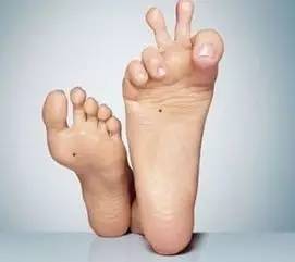 冻疮并不是吹吹就能好的