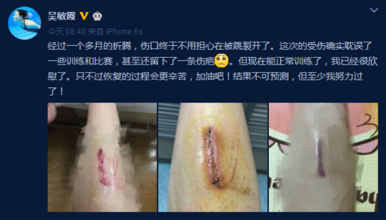 吴敏霞微博晒右腿伤口