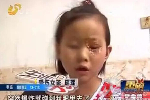音乐蜡烛突然爆炸 6岁女童角结膜眼睑皮肤被烫伤(图)