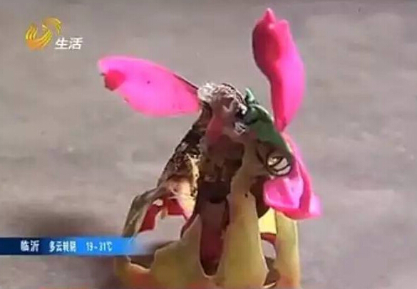 音乐蜡烛突然爆炸 6岁女童角结膜眼睑皮肤被烫伤(图)