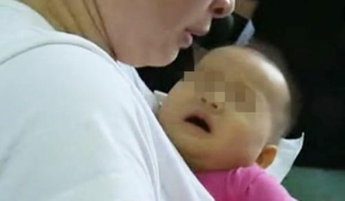 打疫苗眼睛变黄