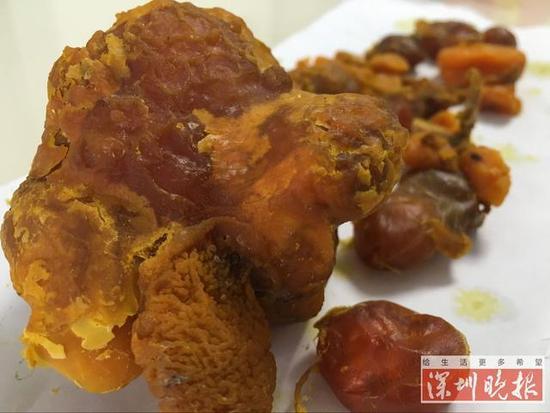 男子杀鸡发现鸡宝 有人出价数百万 鸡宝是什