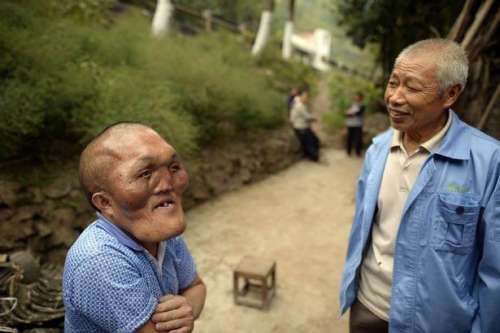 图为患病男子。