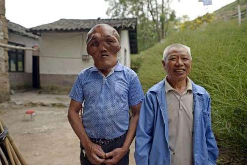 图为患病男子。