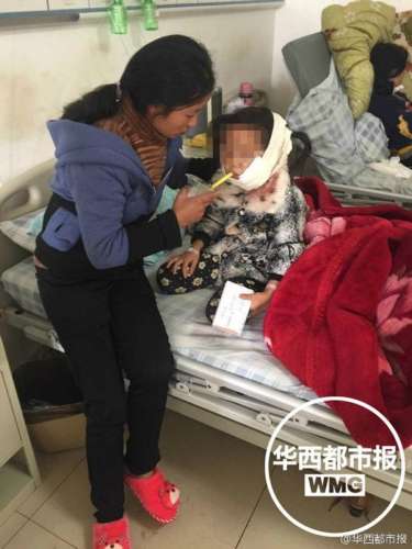 贵州8岁女童惨遭疯狗咬烂半边脸