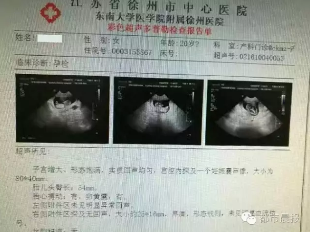 惊！江苏12岁女孩竟到医院做产检