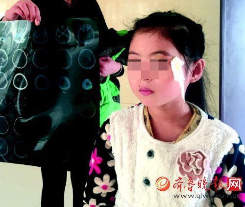 老师丢黑板擦将女生砸破相：失手，想丢她同桌