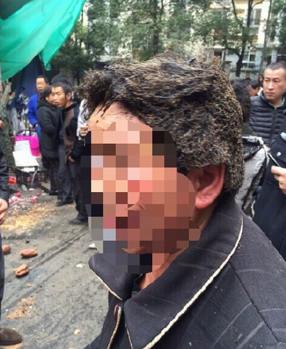 宜昌深圳路菜市场化粪池发生爆炸事故