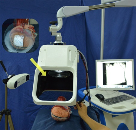 kjc20170704008-2aaaa