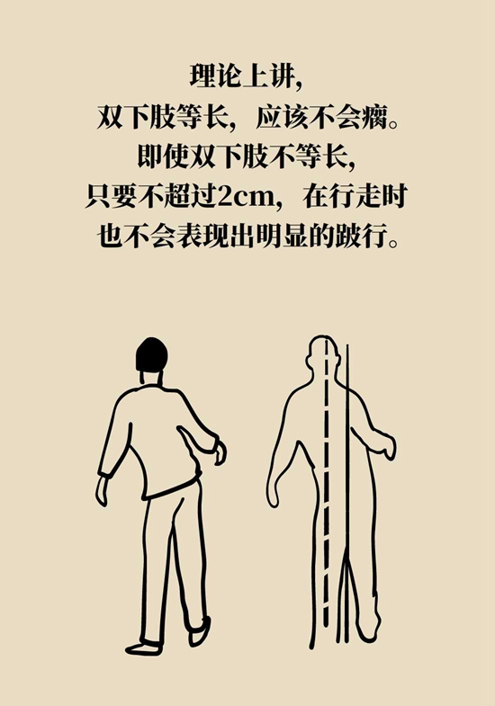 骨折愈合后腿不短也不疼为什么走路却一瘸一拐